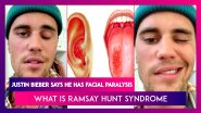 Justin Bieber Says He Has Facial Paralysis: What Is Ramsay Hunt Syndrome