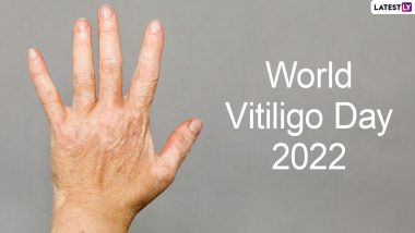 World Vitiligo Day 2022 Date & Significance: What Is Vitiligo? From Causes to Symptoms, Everything To Know About the Chronic Skin Disorder