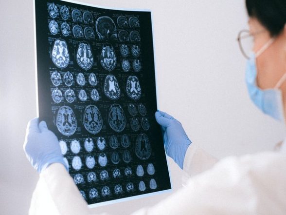Health News | Higher Exposure to Air Pollution is Associated with Higher Functional Brain Connectivity: Study - Vimarsana News