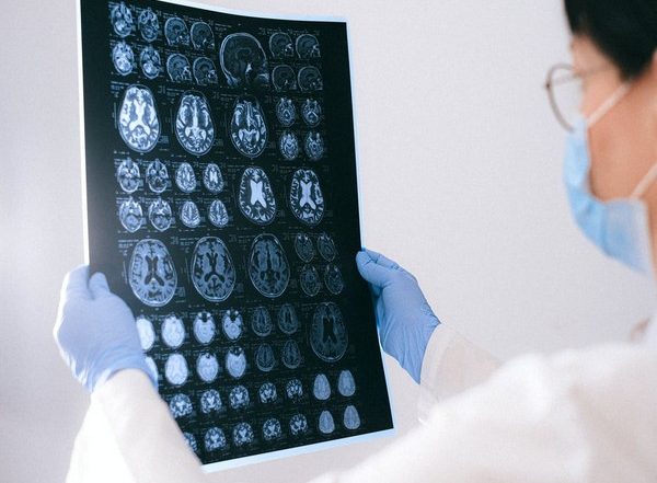 Health News | Higher Exposure to Air Pollution is Associated with Higher Functional Brain Connectivity: Study