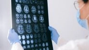Science News | Research Explains Dynamic Cells Associated to Development and Recurrence of Brain Tumour