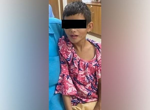 India News | 6-year-old Girl Becomes Youngest to Successfully Undergo POEM Procedure for Obstruction in Food Pipe