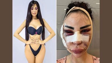 Versace Model Jennifer Pamplona Spent Whopping $600K To Look Like Kim Kardashian; Now Repaying $120K for Detransition (See Pic)