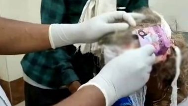 Madhya Pradesh Medical Negligence: Condom Wrapper Used on Woman’s Head To Stop Bleeding From Injury at Community Health Centre in Morena (Watch Video)