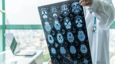 Science News | Researchers Reveal New Approach to Clear Toxic Waste from Brain