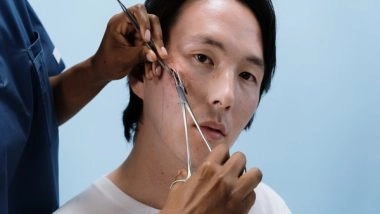 Health News | Microneedling Improves Appearance of Surgical Scars, Especially when Done Early