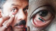 Tiranga on Eyeball! Indian Man Paints National Flag in His Eye To Mark 75th Year of Independence Day (Watch Video)