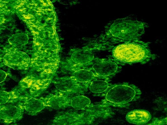 Health News | Study Finds How Highly Resistant Strains of Fungi Emerge - Vimarsana News