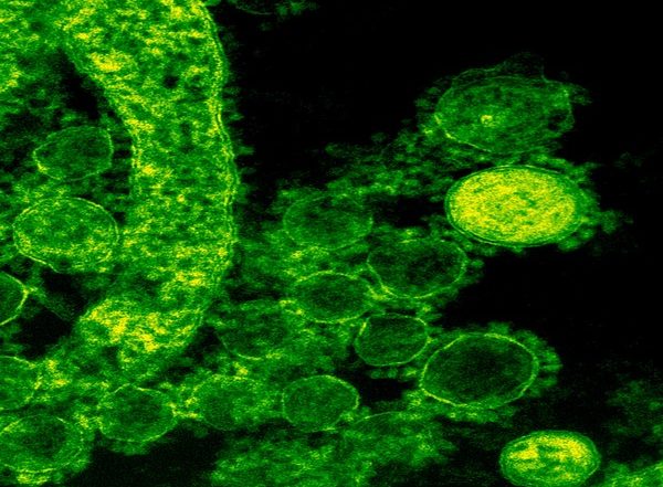 Health News | Study Finds How Highly Resistant Strains of Fungi Emerge