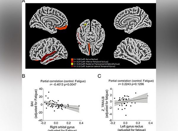 Health News | Study Describes How COVID-19 Damages the Brain