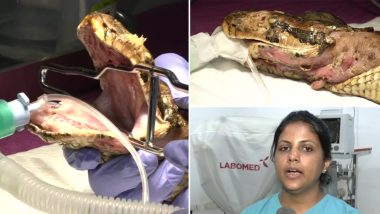 Indian Rock Python, Found With Multiple Fractures and Open Wounds, To Undergo Special Plastic Surgery in Mumbai (See Pics)