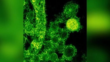 Science News | Researchers Suggest Metals May Help to Fight Fungal Infections