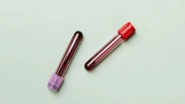 Health News | Blood Tests May Help Detect Who is Likely to Get Long Covid: Study