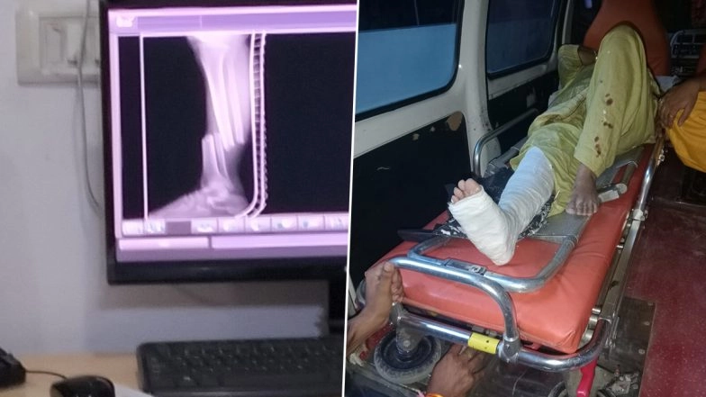 Police Van Rams Into Scooty, Injures Two Women in Delhi