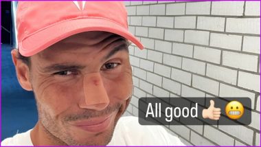 Rafael Nadal Gives Update on his Nose Injury Sustained During US Open 2022 Second Round Match (See Pic)