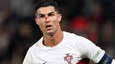 Cristiano Ronaldo Suffers Horrific Face Injury During Portugal vs Czech Republic UEFA Nations League 2022–23 Clash (Watch Video)