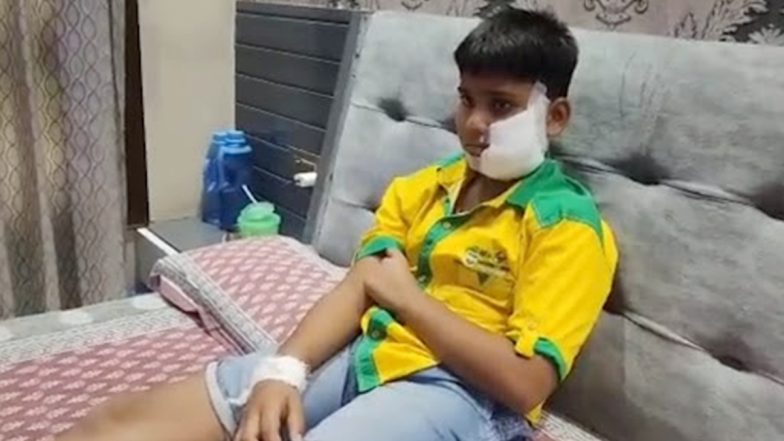 Dog Attack in Ghaziabad: Pitbull Bites 10-Year-Old Boy, Kid Gets Over 150 Stiches; Owner Fined (Video)