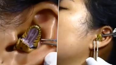 OMG! Snake Gets Trapped in Woman's Ear Hole; Doctor Tries to Pull Out The Reptile With Tongs in Viral Video