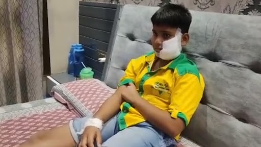 Dog Attack: Pitbull Bites 10-Year-Old Boy in Ghaziabad’s Sanjay Nagar Park, Child Gets 150 Stitches (Watch Video)