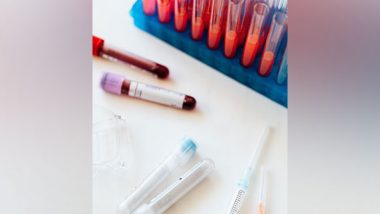 Health News | Study: Blood Tests Might Help to Detect Long Covid in Patients
