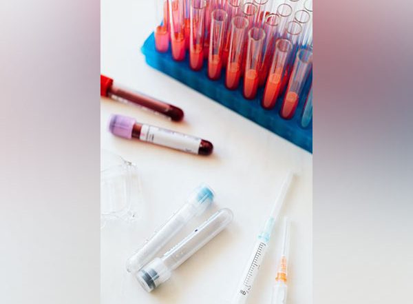 Health News | Study: Blood Tests Might Help to Detect Long Covid in Patients