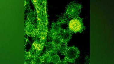 Health News | Immunologic Defect May Leave Some Vulnerable to Rare Bacterial Infection: Study