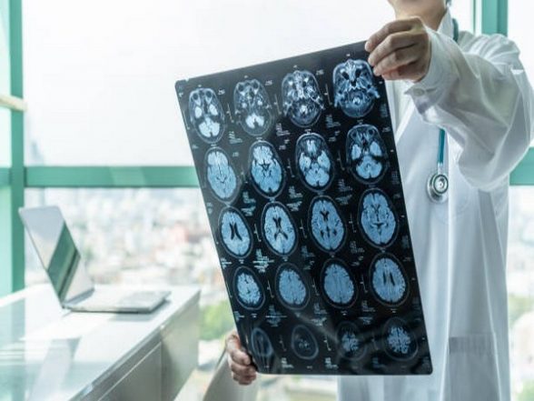 Health News | Researchers Discover New Function of Cerebellum - Vimarsana News