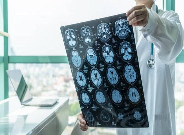 Health News | Researchers Discover New Function of Cerebellum