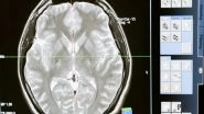 Health News | Study Reveals Cerebellum is Important for Survival