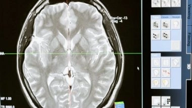 Health News | Study Reveals Cerebellum is Important for Survival