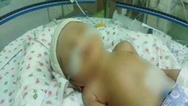 India News | Delhi Hospital Saves Life of 2-day-old Abandoned Girl Child