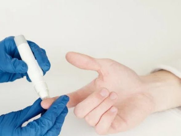 Health News | People Who Have Diabetes More Often Affected by Trigger Finger: Study - Vimarsana News