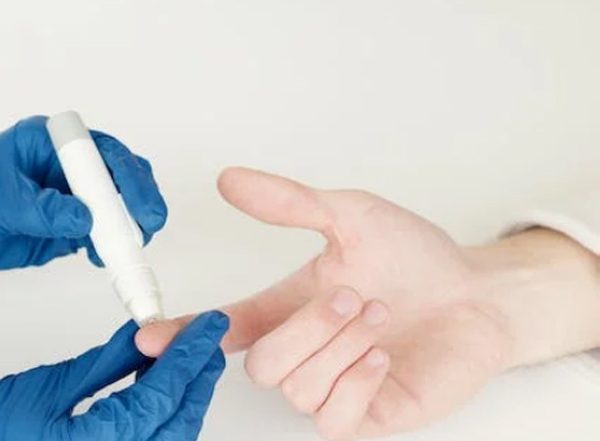 Health News | People Who Have Diabetes More Often Affected by Trigger Finger: Study