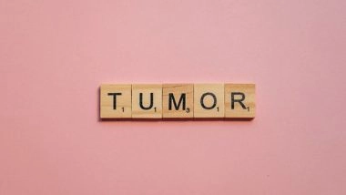 Health News | Study Finds Tumors Suppress the Development of Metastases
