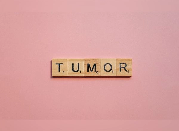 Health News | Study Finds Tumors Suppress the Development of Metastases