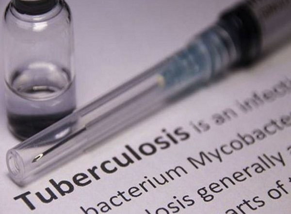 World News | Tuberculosis Cases Surged for the First Time in Many Years: WHO