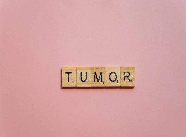 Science News | Pediatric Brain Tumors Can Relapse Due to a Stem Cell Protein