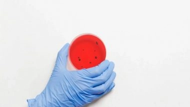 Science News | Study Reveals How Naturally Occurring Compound Kills Major Drug Resistant Bacteria