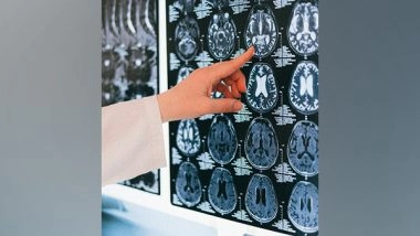 Science News | Research Finds How Single Brain Hemisphere Can Support Words, Face Recognition
