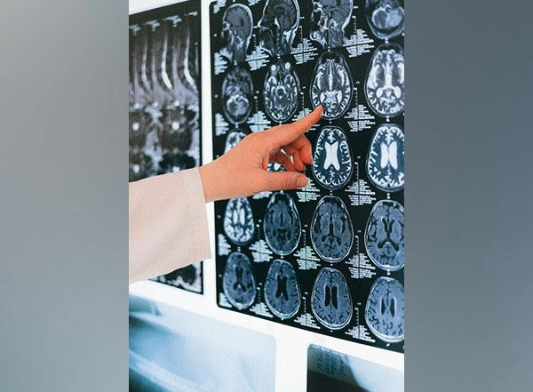 Science News | Research Finds How Single Brain Hemisphere Can Support Words, Face Recognition