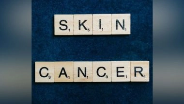 Health News | Melanoma Survivors Might Be Identified Using an Artificial Intelligence Technique: Study