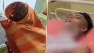 Gujarat Shocker: 'Fire Hair Cut' Goes Wrong, Youth Suffers Burn Injuries in Valsad (Disturbing Video)