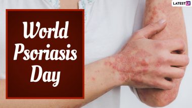 World Psoriasis Day 2022: From Gluten to Alcohol, Food and Drinks That Can Trigger the Disease