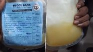 UP Shocker: Dengue Patient Allegedly Given Mosambi Juice Instead of Plasma at Prayagraj Hospital, Dies (Watch Video)