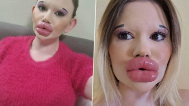 Real-Life Barbie? Bulgarian Woman Who Claims to Have 'World’s Biggest Lips' Plans on Jaw & Chin Fillers, Gets Warning from Docs (See Pics)
