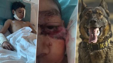 Police Dog Brutally Attacks 13-Year-Old Boy, Rips Off His Face in Australia Allegedly in Break-In Case; Family Demands Justice