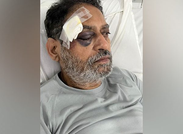 Congress Leader Nitin Raut Injured During Bharat Jodo Yatra in Telangana