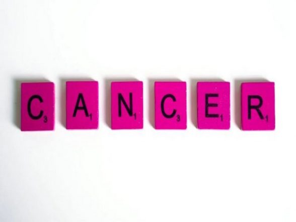 Health News | Adult Cancer Survivors at Higher Risk of Bone Fractures: Research - Vimarsana News