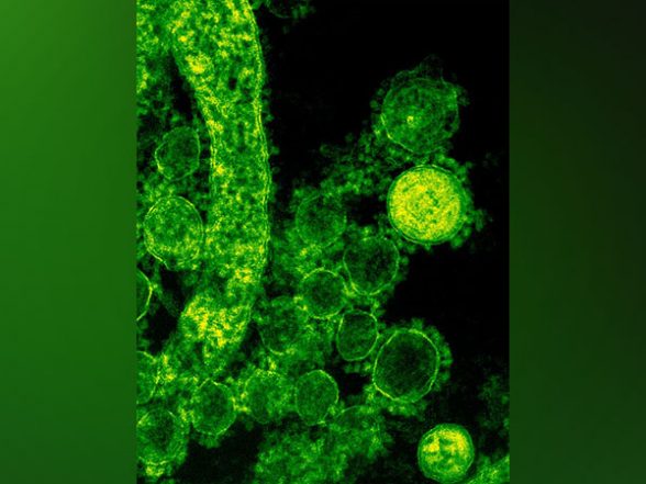 World News | Despite Global Concerns, Pakistan, China Working on Deadly Virus - Vimarsana News