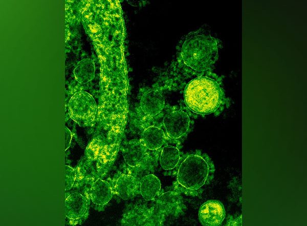 World News | Despite Global Concerns, Pakistan, China Working on Deadly Virus